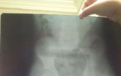 1331 GABO radiografia JOSE GREGORIO H